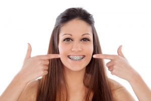 Foods to Eat After Getting Braces Tightened
